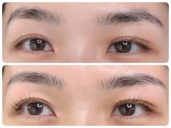 トータルビューティ ノイド(Noid)/パリジェンヌ＆眉WAX脱毛