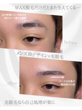 リノア(Linoa)/メンズ眉毛ビフォーアフター
