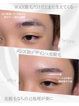 リノア(Linoa)/メンズ眉毛ビフォーアフター