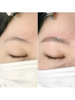 アマリリス(Amaryllis)/ハリウッドブロウリフト(HBL)