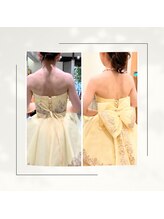 サンテボーテ(Sante Beaute)/ブライダルBefore⇒After