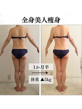 リルチェ 自由が丘(RILUCE)/全身美人痩身効果写真