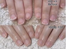 自爪育成で貝爪さんもこの通り！フォルムの変化で気持ちも明るく