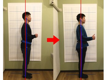 緑区こころ整体院/骨盤・猫背矯正での変化！