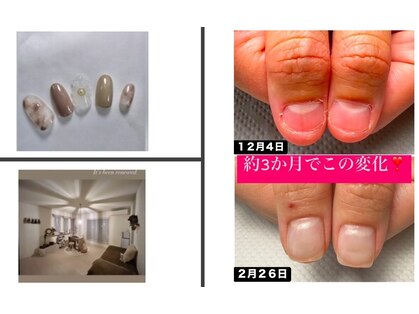 タヌ(TANU)の写真