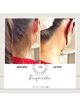 プライベートサロン 安樹/1ヶ月に1回通って12回でこの効果