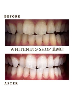 ホワイトニングショップ 葛西店/歯科提携 ホワイトニング専門店