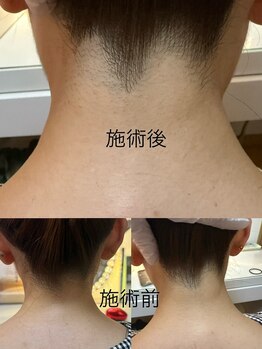 ミナミ/360°綺麗な姿で。 