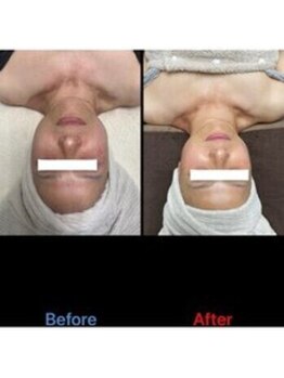 ゴールデンケア 岡崎店(Golden Care)/シミ・毛穴洗浄・フェイシャル