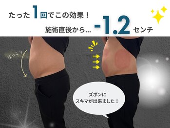 ウナ 福岡店(UNA)/ぽっこりお腹撃退☆1回で-1.2cm