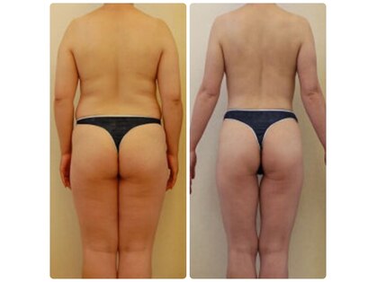 リ オアシス(Re:Oasis)の写真