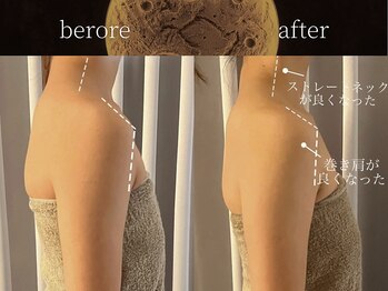 リムーン(REMOON.)/施術後の効果★