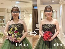 ブライダルケアもとっても大人気！夢の花嫁！全力サポート☆