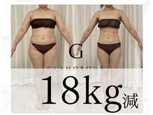 歴10年以上のブライダルエステとダイエットのプロにお任せ！