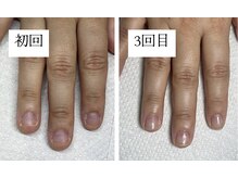 ニコッテ 本厚木(nicotte.)の雰囲気（自爪に関するお悩みは自爪育成コースがおすすめ）