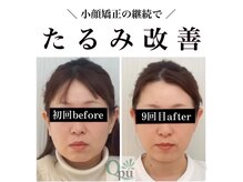 キュープ 浜松店(Qpu)の雰囲気（女性のための女性による小顔美容矯正専門店です！）