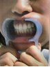 歯のセルフホワイトニング(1回)60分5500円