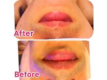 ビモア(Bmore)/★ビフォー・アフター★Vol.2