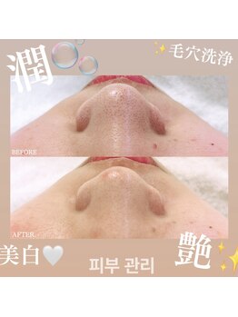 エテルナ(ETERNA)/肌管理