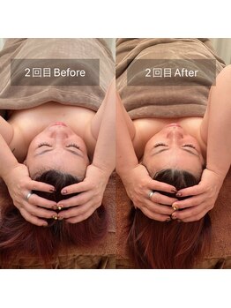 スリージー/before/after