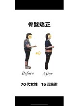 北てんま整骨鍼灸院/70代でもまだまだいける！！