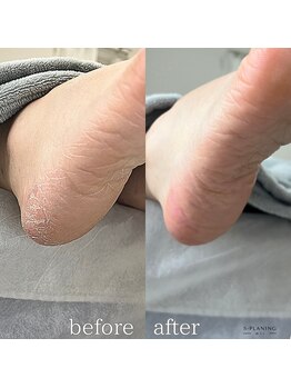 フットミー(foot mii)/