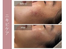 ジョルネ 中目黒(jornee.)/before/after