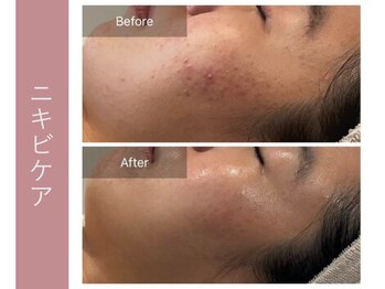 ジョルネ 中目黒(jornee.)/before/after