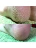 フット角質ケア【ジェルメニューにプラスワン】
