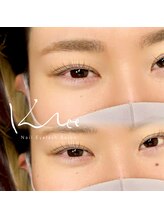 クレー(Klee)/上下ラッシュリフト