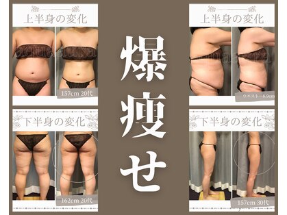 ボディエステティック アクアオーラ 富山店の写真