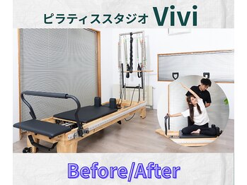 ヴィヴィ(Vivi)/ビフォーアフター