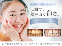 エヌエーホワイトニング たまプラーザ店(NAホワイトニング)
