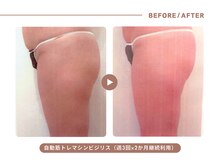 イエス マイサロン(yes My Salon)/自動筋トレマシンBIJIRIS施術例