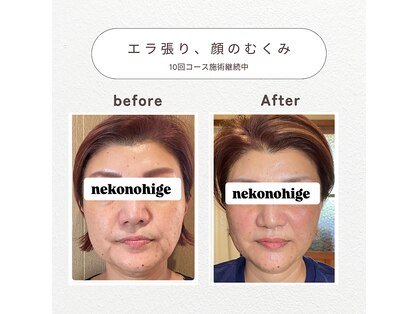 ねこのひげの写真