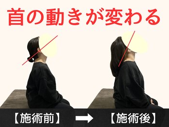 パルマ なかもず(Palma)/整体/頭痛/肩こり/ヘッドスパ