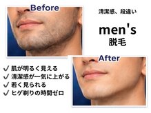 シュガーリングハウス ベル(Bell)の雰囲気（男性ダントツ人気のヒゲ脱毛！効果重視◎本気のヒゲ脱毛！！）