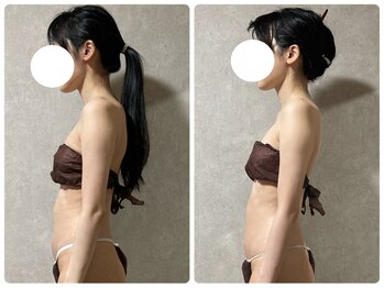 スリーピングビューティー(Sleeping Beauty)/インディバ　巻肩