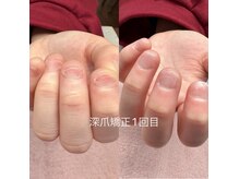 ゆくい