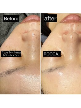 ロッカ(ROCCA..)/フェイシャルWaxトリートメント