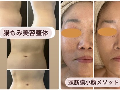 ソカ(SOKA)の写真