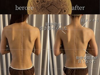 リムーン(REMOON.)/施術後の効果★