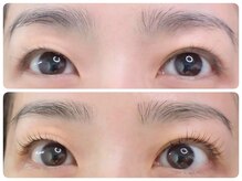 トータルビューティ ノイド(Noid)/パリジェンヌ＆眉WAX脱毛