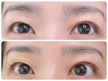 トータルビューティ ノイド(Noid)/パリジェンヌ＆眉WAX脱毛