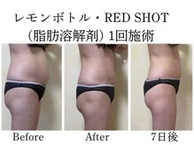 スターティス(STATICE)の雰囲気（結果重視◎ノアグロウ使用し肌の内側にダイレクトに届けます！）