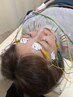 【大分県初!通常の美容鍼よりもワンランク上の効果】レッドダッド美容鍼