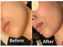 サロン デ ミロ(Salon de Miro)/BeforeAfter多数！ブログへGO♪