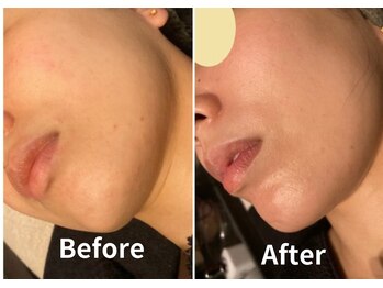 サロン デ ミロ(Salon de Miro)/BeforeAfter多数！ブログへGO♪