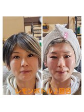 アン 銀座(ann)/レモンボトル2回目