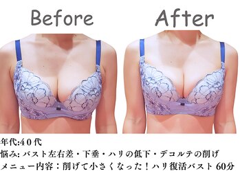 シエル(Siele)/身体の歪みを整えず育乳すると…